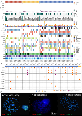 Oncogenic drivers shape the tumor microenvironment in human gliomas