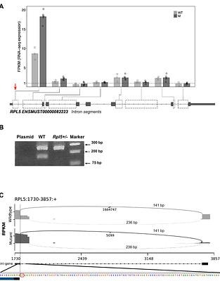 A lipid metabolism defect is an underlying contributor to Diamond Blackfan anemia syndrome