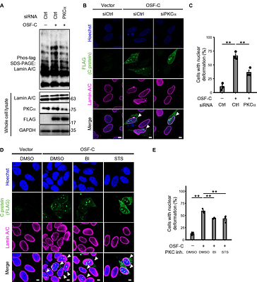 West Nile virus capsid protein promotes viral replication and pathogenesis through PKCα-dependent lamin phosphorylation and nuclear deformation