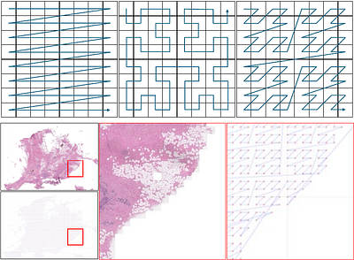 Exploring Multi-Scale Local and Global Features in Whole Slide Images Using State Space Models