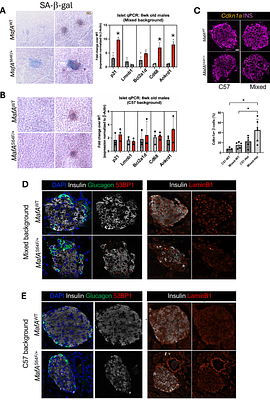 Genetic background influences the heterogeneous phenotypes driven by the MAFAS64F MODY variant in male mice