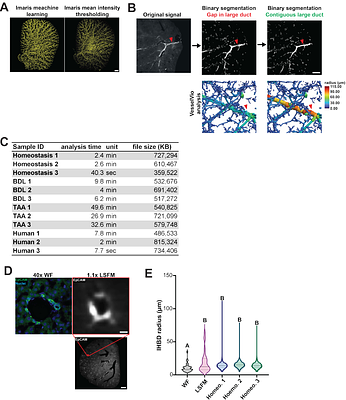 Quantitative 3D imaging of mouse and human intrahepatic bile ducts in homeostasis and liver injury
