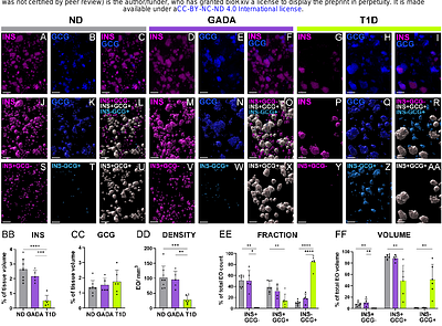 3D imaging of human pancreas suggests islet size and endocrine composition influence their loss in type 1 diabetes