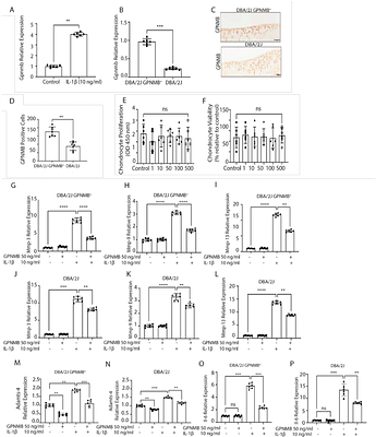 The Anti-Inflammatory Role of GPNMB in Post-Traumatic Osteoarthritis