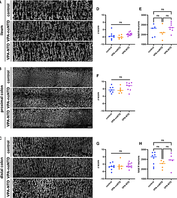 Abnormal enteric nervous system organization and gastrointestinal motility in mice with valproic acid-induced neural tube defects
