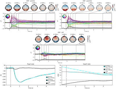Decoding the epistemic arc: Distinct physiological signatures for curiosity, insight, understanding and liking during interactions with visual art
