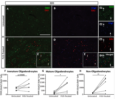 The Modulation of the Blood-Brain Barrier by Focused Ultrasound Stimulates Oligodendrogenesis