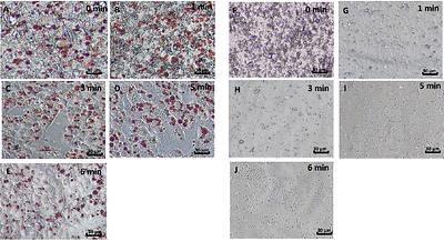 ACTIVATED CASO₄-INDUCED VACUOLATION AS A QUANTITATIVE PLATFORM FOR PHAGOCYTOSIS-DRIVEN DRUG SCREENING