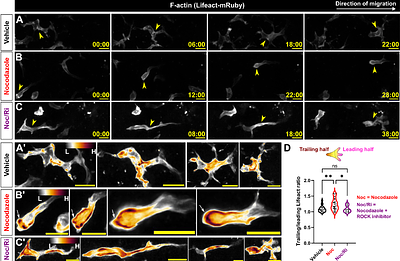Microtubule-dependent cell polarity regulates skin-resident macrophage phagocytosis and directed cell migration
