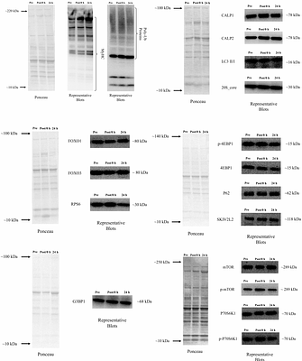 Large increases in resistance training volume do not impair skeletal muscle hypertrophy or anabolic-catabolic molecular signalling in trained individuals