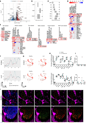 Lung cancer-fueled emergency myelopoiesis is characterized by an increase of S100A9+ and LCN2+ hematopoietic stem and progenitor cells