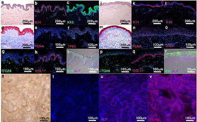 De Novo Regeneration of Rete Ridges during Cetacean skin wound healing