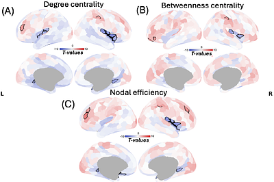 Organization of functional brain networks architecture during negative movie watching in late adulthood