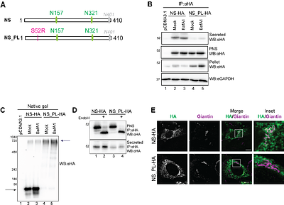The role of N-glycans and their processing in ER-to-lysosome-associated degradation of disease-causing mutant Neuroserpin