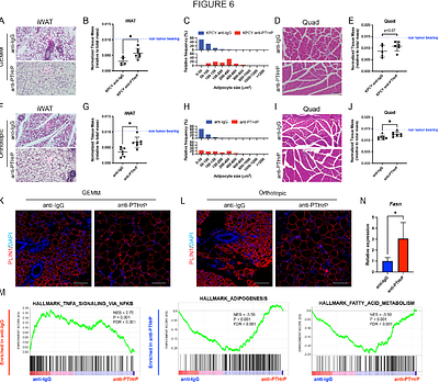 Pancreatic cancer cachexia is mediated by PTHrP-driven disruption of adipose de novo lipogenesis