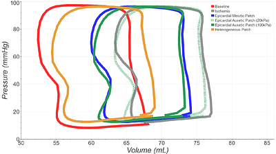 Auxetic patch material exhibits systolic thickening and restores pump function in a finite element model of acute myocardial infarction repair