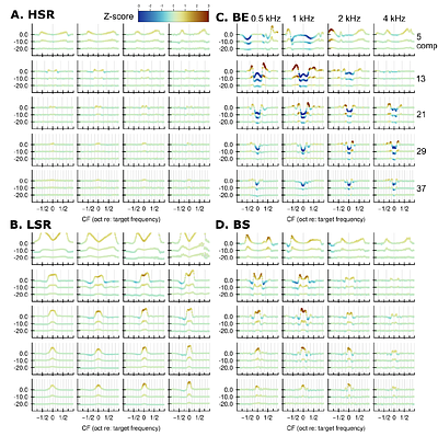 Profile analysis in listeners with sensorineural hearing loss: behavioral data and computational models