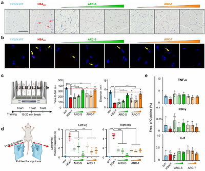 Treating Myotonic Dystrophy with artificial RNA endonucleases to specifically degrade toxic RNA expansions