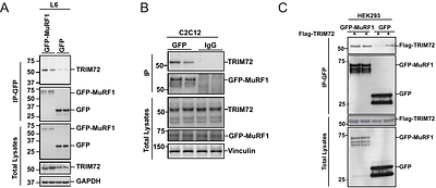 MuRF1 partners with TRIM72 to impair insulin signalling in skeletal muscle cells
