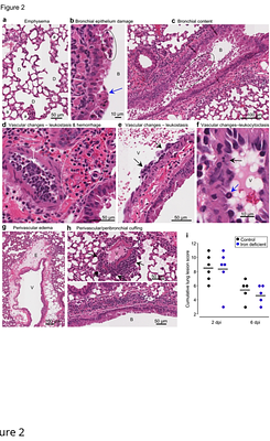 The effects of iron deficient and high iron diets on SARS-CoV-2 lung infection and disease