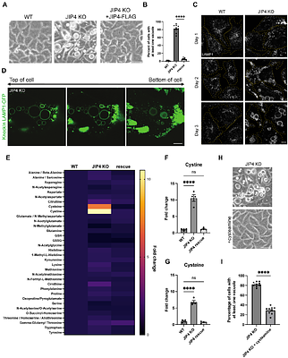 JIP4 deficiency causes a novel lysosome storage disease arising from impaired cystine efflux