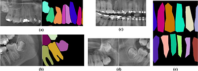 A Deep Learning Approach to Teeth Segmentation and Orientation from
  Panoramic X-rays