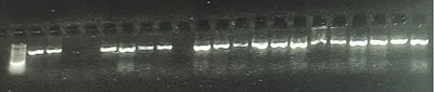 Leech Speciation and Detection of Hirudin Gene among the Leech Population in Asejire Oyo State, Nigeria
