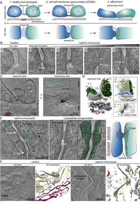 Cryo-electron tomographic analysis of anti-nephrin-mediated podocytopathy