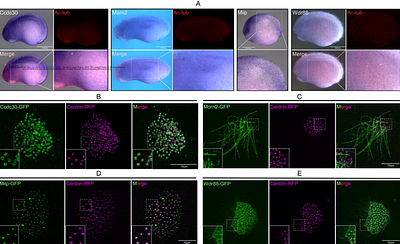 Beyond the Axoneme: Whole-Cell Proteomics Identifies Novel Regulators of Ciliogenesis in Xenopus Epidermal Multiciliated Cells