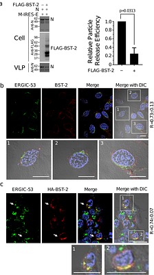 BST-2 inhibits SARS-CoV-2 egress at intracellular membranes and is neutralized by ORF7a