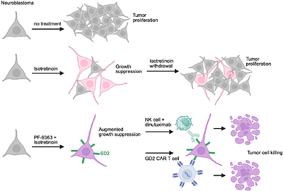 KAT6A/B inhibition synergizes with retinoic acid and enhances the efficacy of GD2-targeted immunotherapy in neuroblastoma