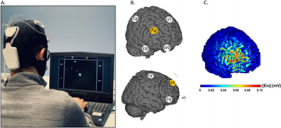 Transcranial random noise stimulation over the right prefrontal cortex does not improve performance on trained or untrained complex cognitive tasks