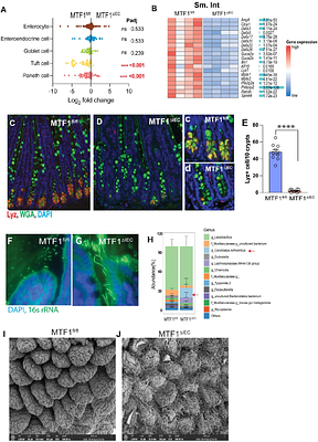 Epithelium intrinsic zinc sensor controls immune homeostasis with gut microbes via regulation of Tuft cell lineage