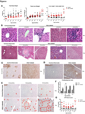 Longitudinal study of liver disease progression in the PEX1-Gly844Asp mouse model of mild Zellweger Spectrum Disorder