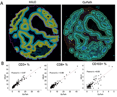 Comparison of QuPath and HALO platforms for analysis of the tumor microenvironment in prostate cancer