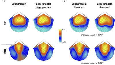 Auditory attention reorganizes the phase alignment of neural oscillations