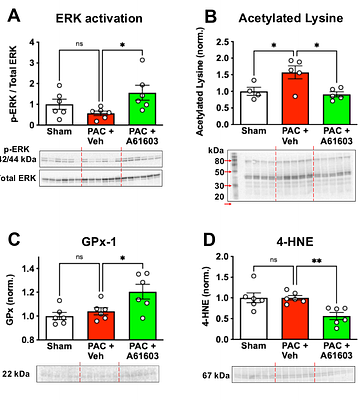 Chronic therapy with α1A-adrenergic agonist reverses RV failure and mitochondrial dysfunction