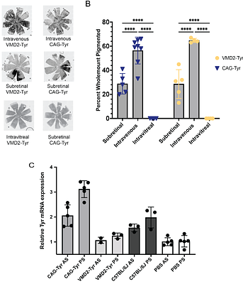 Systemic, RPE-directed AAV-Tyrosinase therapy restores ocular pigmentation in an OCA1 mouse model