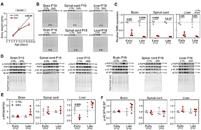 Translation-specific disruption of Col1a1 expression in multiple models of Spinal Muscular Atrophy can be rescued by Risdiplam.