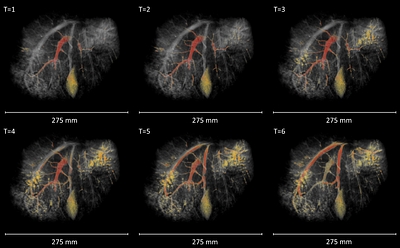 Real time evaluation of the liver microcirculation by whole organ machine perfusion within an MRI system