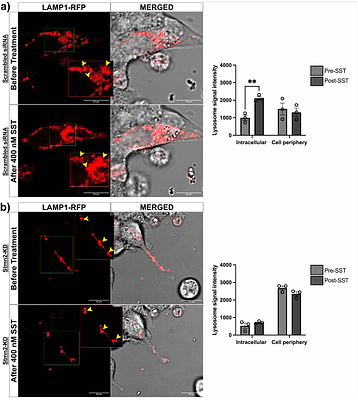 Stathmin-2 Mediates Paracrine Hormone Regulation of Glucagon Through Lysosomal Trafficking in αTC1-6 cells