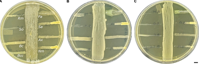 Differential Metabolite Production Underlies Disruption of the Cystic Fibrosis Airway Microbiota by Pathogens