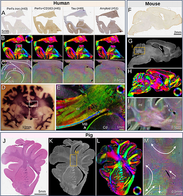 Uncovering microstructural architecture from histology