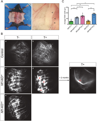 Exploring the mechanisms governing the initiation of plexiform neurofibromas using Prss56Cre,Nf1-KO mouse model at a single-cell resolution