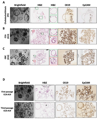 A guide for establishing patient-derived organoids from bile samples obtained during endoscopic procedures and performing gene expression knockdown