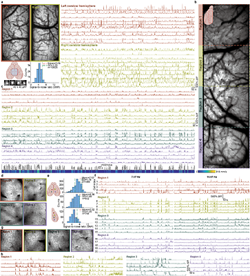 Ultra-wide-field, deep, adaptive two-photon microscopy