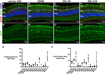 Deep learning design and in vivo validation of Müller glia-specific cis-regulatory elements