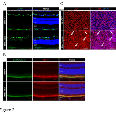 DAPL1 deficiency impairs autophagy in retinal pigment epithelium to drive age-dependent retinal pathologies