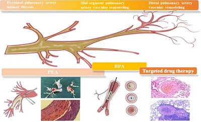 Construction of Animal Models Based on Exploring Pathological Features and Mechanisms of Different Locations in the Progression of DVT-APTE-CTEPD/CTEPH