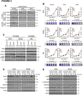 TRIB3 silencing promotes the downregulation of Akt pathway and PAX3-FOXO1 in high-risk rhabdomyosarcoma
